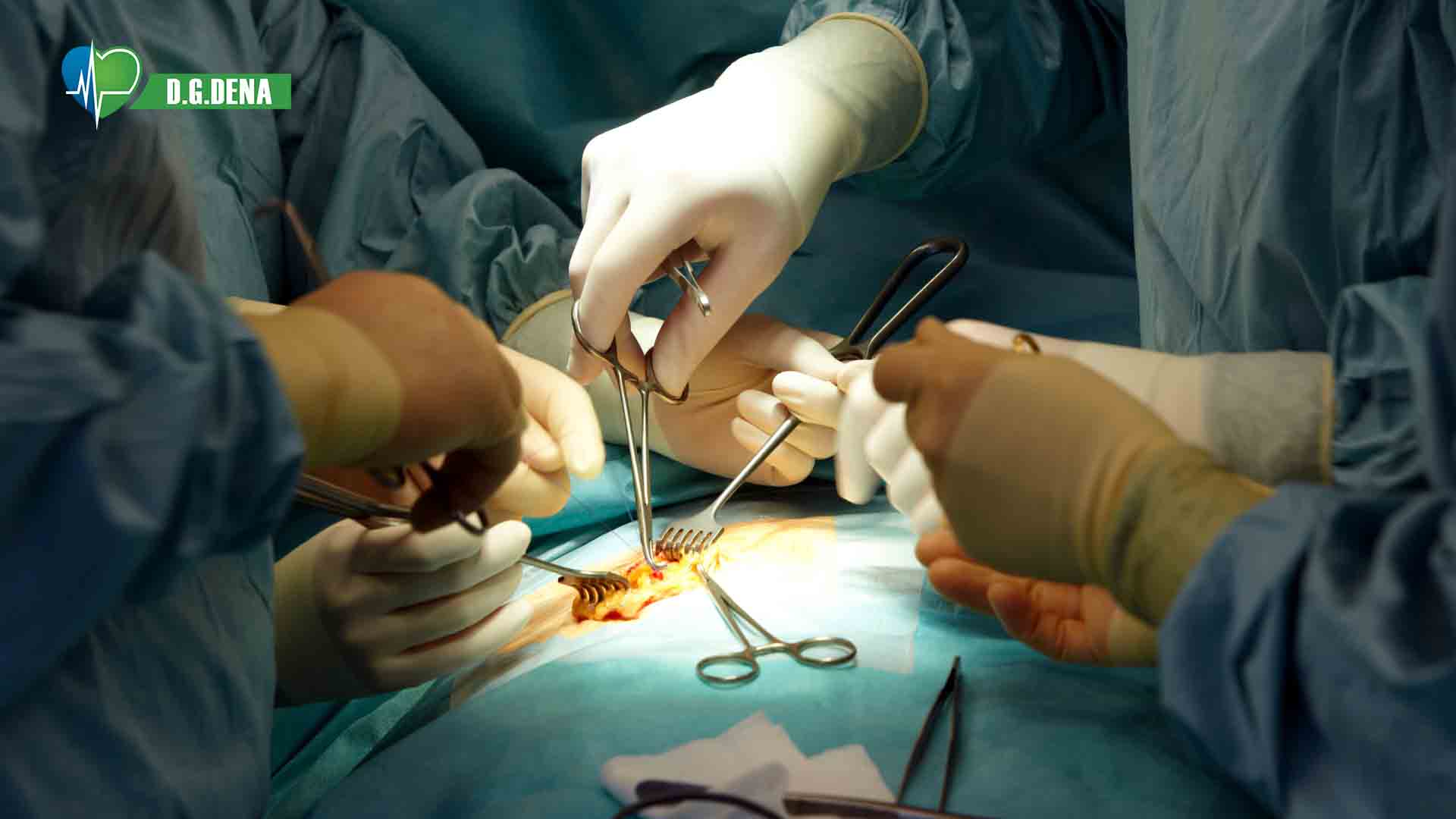 Surgical Site Infections Treatment